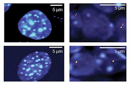 熒光原位雜交技術(shù)（Fluorescence in situ hybridization，F(xiàn)ISH）